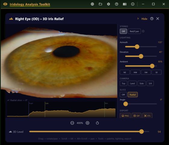 3D iris relief viewer showing the iris as a lit height-map terrain, with stereo, lighting, camera, slice and export controls