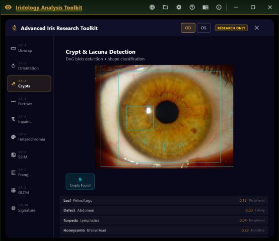 Advanced Iris Research Toolkit with a tool sidebar and crypt and lacuna detection running, showing nine detected crypts classified by type