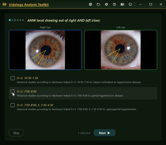 Velchover wizard page showing both irides with drawn guides and three tick-box pattern options, with Skip and Next buttons