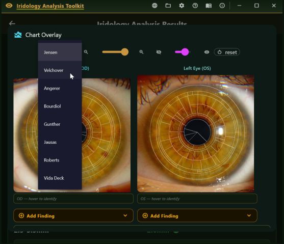 Chart overlay dialog with a dropdown listing eight historical iridology chart authors