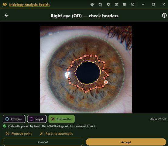 Collarette traced by hand as a ring of points around the pupil, with the ANW percentage shown live