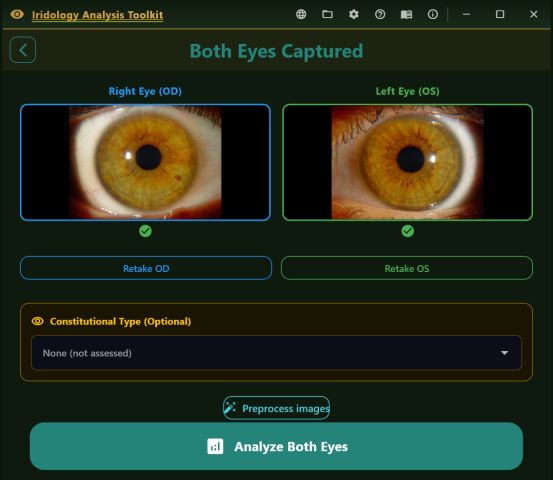 Both Eyes Captured screen with the two iris photographs, retake buttons, an optional constitutional type field and the Analyze Both Eyes button