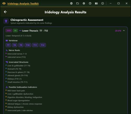 Chiropractic assessment panel showing a lower thoracic segment with vertebrae, nerve roots, innervated structures and possible subluxation indicators