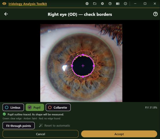Border check editor for the right eye, with Limbus, Pupil and Collarette chips, the traced pupil outline and a live P/I readout