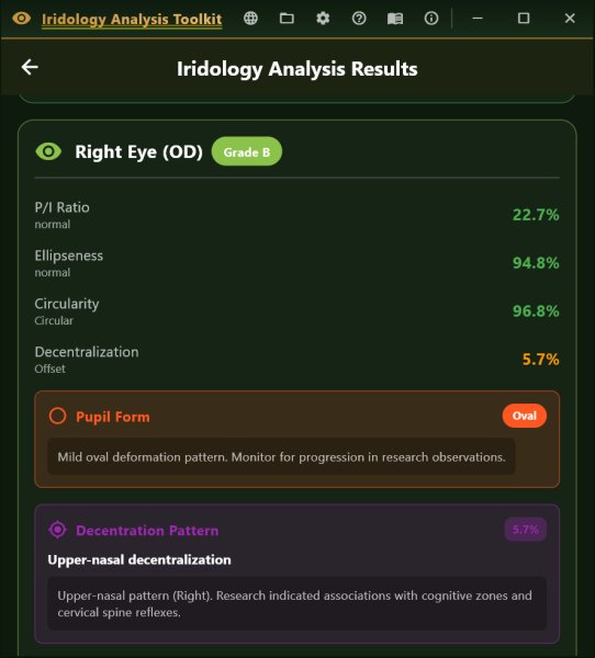 11-results