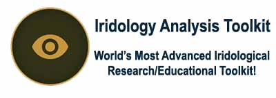 Iridology Software