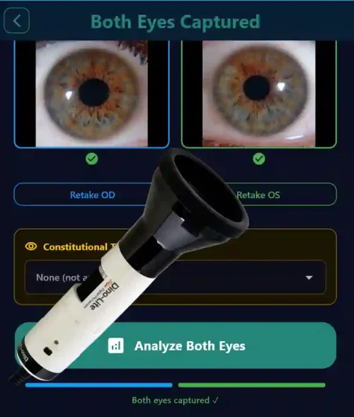 Iridology Analysis Toolkit Iriscope Bundle