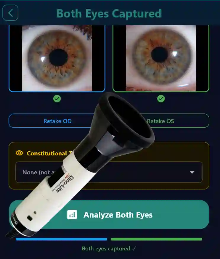 Iridology Analysis Toolkit Iriscope Bundle